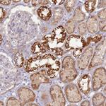 UQCRQ Antibody in Immunohistochemistry (Paraffin) (IHC (P))