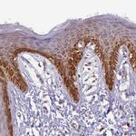 UQCRQ Antibody in Immunohistochemistry (Paraffin) (IHC (P))
