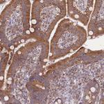 BOLA2 Polyclonal Antibody