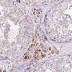BOLA2 Antibody in Immunohistochemistry (Paraffin) (IHC (P))