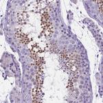 C6orf154 Antibody in Immunohistochemistry (IHC)