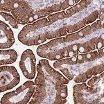 MEIS3 Antibody in Immunohistochemistry (Paraffin) (IHC (P))