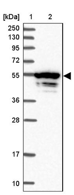 MEIS3 Antibody in Western Blot (WB)