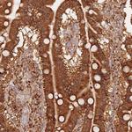 OR5V1 Antibody in Immunohistochemistry (Paraffin) (IHC (P))