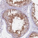 DOM3Z Antibody in Immunohistochemistry (Paraffin) (IHC (P))
