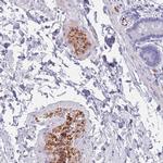 OR5D16 Polyclonal Antibody