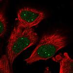 PSMG2 Polyclonal Antibody