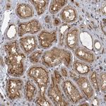 PSMG2 Antibody in Immunohistochemistry (Paraffin) (IHC (P))