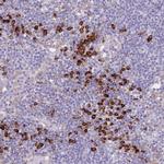 C19orf10 Antibody in Immunohistochemistry (Paraffin) (IHC (P))