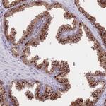 C19orf10 Antibody in Immunohistochemistry (Paraffin) (IHC (P))