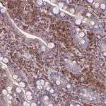 ZSWIM1 Antibody in Immunohistochemistry (Paraffin) (IHC (P))