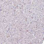 ZSWIM1 Antibody in Immunohistochemistry (Paraffin) (IHC (P))