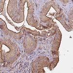 CYP2U1 Polyclonal Antibody