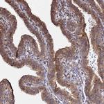 NUDT14 Antibody in Immunohistochemistry (Paraffin) (IHC (P))