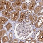 NUDT14 Antibody in Immunohistochemistry (Paraffin) (IHC (P))