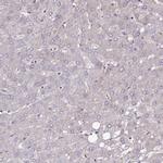 NUDT14 Antibody in Immunohistochemistry (Paraffin) (IHC (P))
