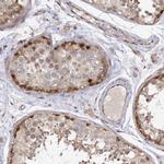 NUDT14 Antibody in Immunohistochemistry (Paraffin) (IHC (P))