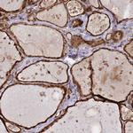 NUDT14 Antibody in Immunohistochemistry (Paraffin) (IHC (P))
