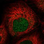 ZNF577 Antibody in Immunocytochemistry (ICC/IF)