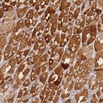 ZNF577 Antibody in Immunohistochemistry (Paraffin) (IHC (P))