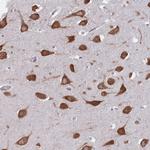 CCDC124 Antibody in Immunohistochemistry (Paraffin) (IHC (P))