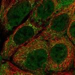 PIGU Polyclonal Antibody