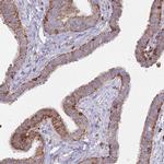 MRPL54 Antibody in Immunohistochemistry (IHC)