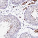 IRGC Polyclonal Antibody