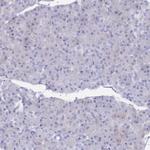 ST8SIA5 Antibody in Immunohistochemistry (Paraffin) (IHC (P))