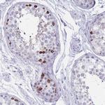 ST8SIA5 Antibody in Immunohistochemistry (Paraffin) (IHC (P))