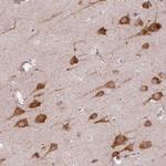 COX18 Antibody in Immunohistochemistry (Paraffin) (IHC (P))