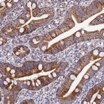 MRPS12 Antibody in Immunohistochemistry (Paraffin) (IHC (P))