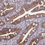 MRPS12 Antibody in Immunohistochemistry (IHC)