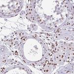 BTBD10 Antibody in Immunohistochemistry (Paraffin) (IHC (P))