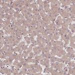 C14orf129 Antibody in Immunohistochemistry (Paraffin) (IHC (P))