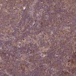 C14orf129 Antibody in Immunohistochemistry (Paraffin) (IHC (P))