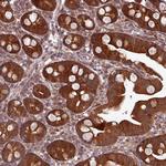 C14orf129 Antibody in Immunohistochemistry (Paraffin) (IHC (P))
