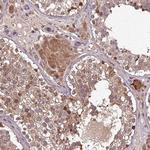 C14orf129 Polyclonal Antibody