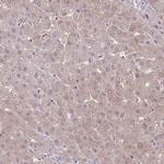 PAIP2B Antibody in Immunohistochemistry (Paraffin) (IHC (P))