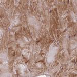 PAIP2B Polyclonal Antibody