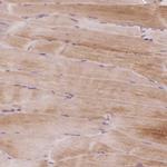 PRRC2A Antibody in Immunohistochemistry (Paraffin) (IHC (P))