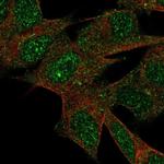 LRRN3 Polyclonal Antibody