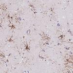 LRRN3 Antibody in Immunohistochemistry (Paraffin) (IHC (P))