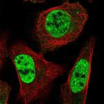 ST5 Antibody in Immunocytochemistry (ICC/IF)