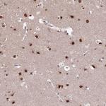 ST5 Antibody in Immunohistochemistry (Paraffin) (IHC (P))