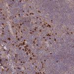 MPEG1 Antibody in Immunohistochemistry (IHC)