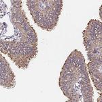 CF136 Antibody in Immunohistochemistry (Paraffin) (IHC (P))