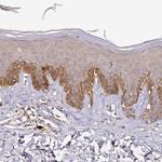 CF136 Antibody in Immunohistochemistry (Paraffin) (IHC (P))