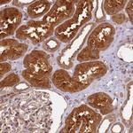 SCGB2B2 Polyclonal Antibody