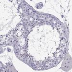 IQCD Polyclonal Antibody